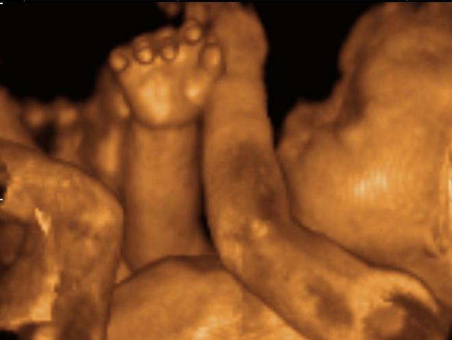 3 awe-inspiring, life-changing lessons from a simple ultrasound